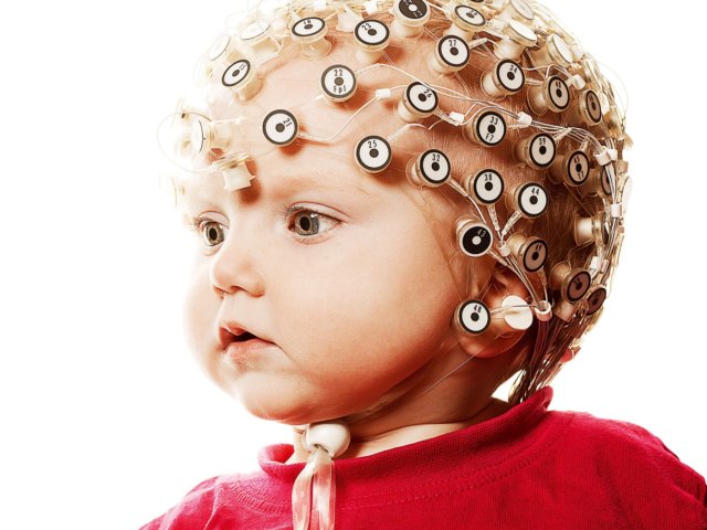 cocuklarda-eeg